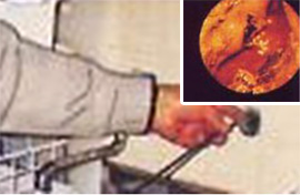 検査項目13　内視鏡調査　ファイバースコープ